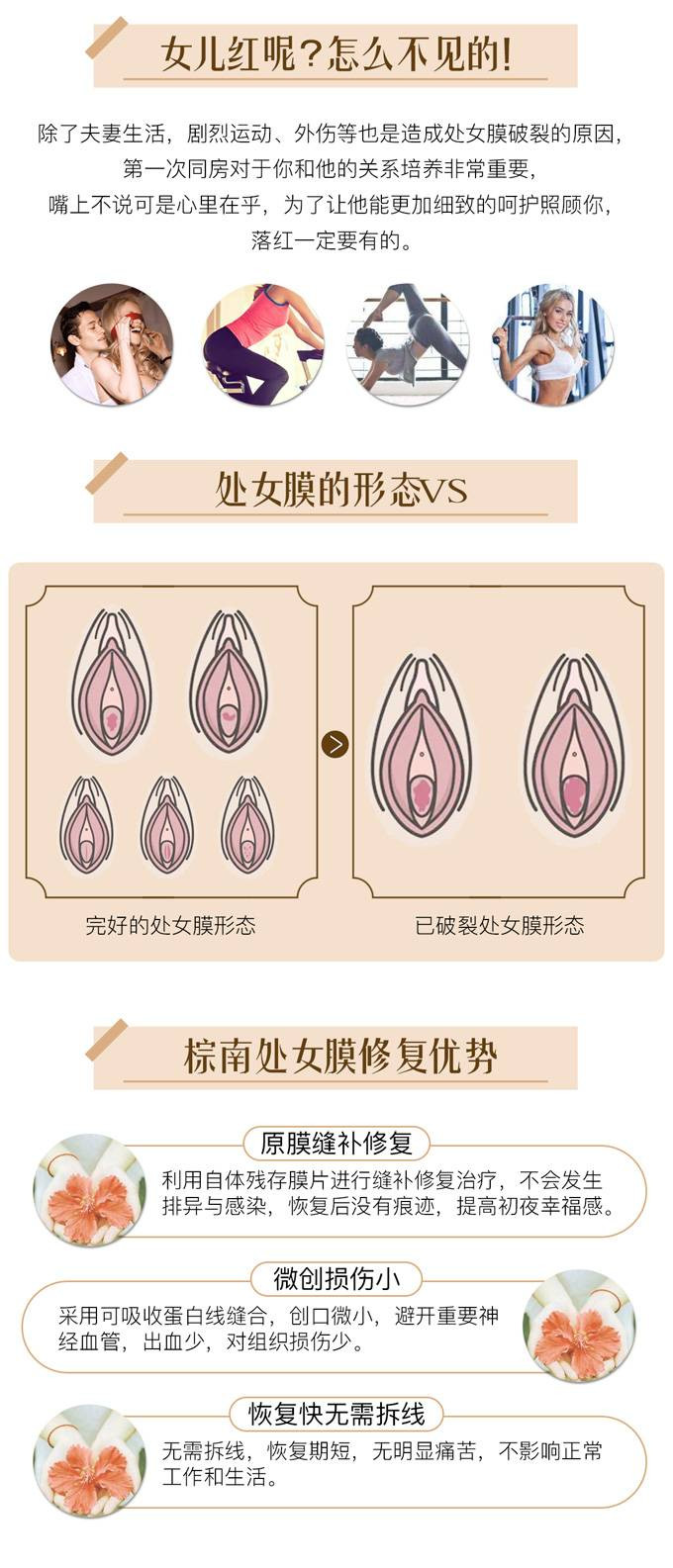 处女膜修复哪家医院好-处女膜修复价格效果如何